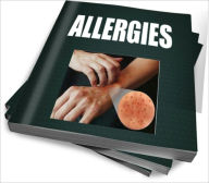 Title: Allergies: Food Allergy Symptoms And Allergy Treatment Tips, Author: Janus I. Marquez