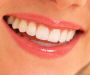 How To Have Beautiful Teeth For A Lifetime-How To Smile Like A Movie Star