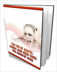 Title: Get rid of warts, moles and skin tags the natural way!, Author: Bdp