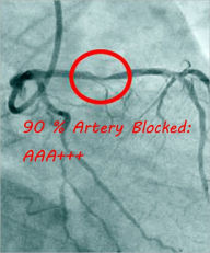 Title: 94% Artery Blockage ---AAA+++, Author: Captain Pierre