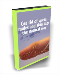 Title: Get Rid Of Warts, Moles And Skin Tags The Natural Way, Author: Lou Diamond