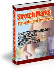 Title: Stretch Marks - Prevention And Treatment - Learn What Exactly Are Stretch Marks And How Can They Be Treated, Author: Irwing