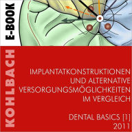 Title: Implantatkonstruktionen und alternative Versorgungsmöglichkeiten im Vergleich Basics 1 (German Edition), Author: Wolfgang Kohlbach