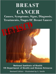Title: BREAST CANCER: Causes, Symptoms, Signs, Diagnosis, Treatments, Stages Of Breast Cancer - Revised Edition - Illustrated by S. Smith, Author: U.S. DEPARTMENT OF HEALTH AND HUMAN SERVICES