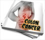 A Complete Health Guide To Colon Cancer