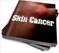 Title: What Skin Cancer Is All About - Treatment And Prevention, Author: Elvira G. Rangel