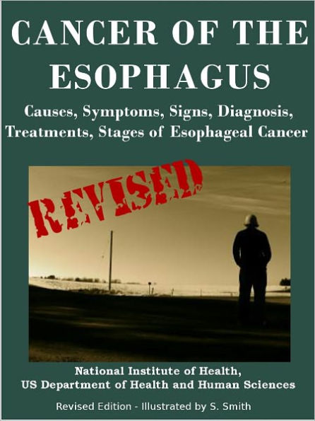 CANCER OF THE ESOPHAGUS: Causes, Symptoms, Signs, Diagnosis, Treatments ...