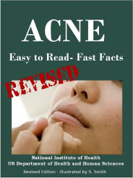Title: ACNE: Easy to Read- Fast Facts - Edited by S. Smith - Illustrated by S. Smith, Author: U.S. DEPARTMENT OF HEALTH AND HUMAN SERVICES