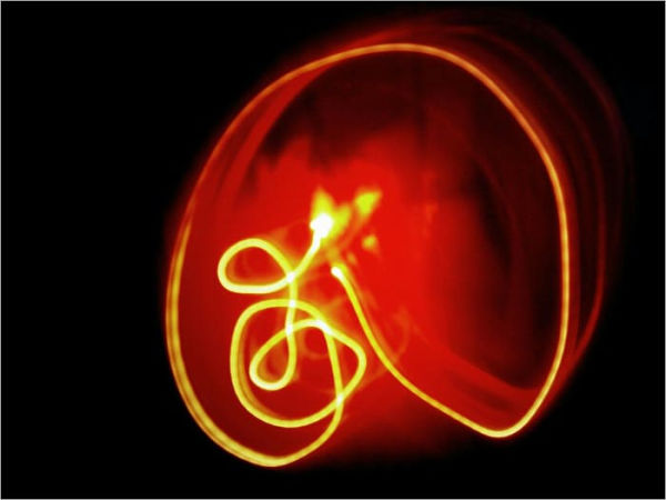 Endometriosis: Endometriosis Information You Need to Know