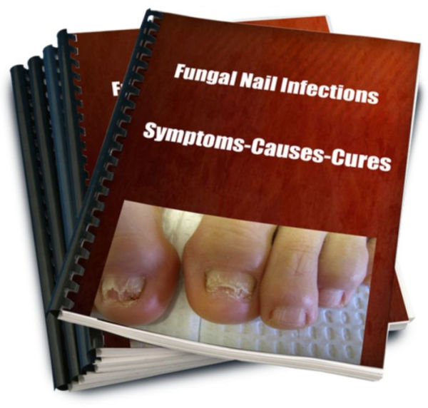 Fungal Nail Infections-Symptoms-Causes-Cures