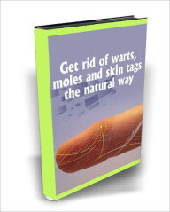 Title: Get Rid Of Warts, Moles And Skin Tags The Natural Way, Author: Dawn Publishing