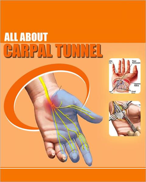 All About Carpel Tunnel by Eileen Meisinger | eBook | Barnes & Noble®