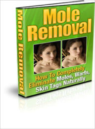 Title: Mole Removal, Author: Dawn Publishing