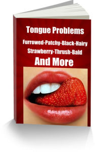 Title: Tongue Problems-Furrowed-Patchy-Black-Hairy-Strawberry-Thrush-Bald-Scrotal Geographic-White Patches-Tongue Piercing-Dark, Swollen Tongue, Author: Janice Rice