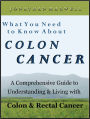 What You Need to Know About Colon Cancer: A Comprehensive Guide to Understanding and Living with Colon and Rectal Cancer