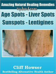 Title: Amazing Natural Healing Remedies - Age Spots - Liver Spots - Sunspots - Lentigines, Author: Cliff Howser