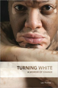 Title: Turning White, Author: Lee Thomas