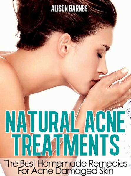 Natural Acne Treatments