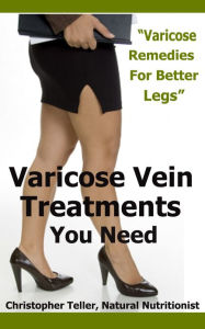 Title: Varicose Vein Treatments You Need: Varicose Remedies For Better Legs, Author: Christopher Teller