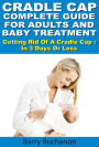 Cradle Cap : Complete Guide For Adults And Baby Treatment Getting Rid Of A Cradle Cap :In 3 Days Or Less