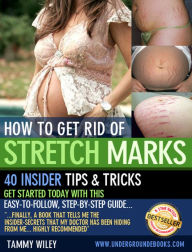 Title: How to Get Rid of Stretch Marks, Author: Tammy Wiley