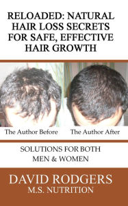 Title: Reloaded: Natural Hair Loss Secrets for Safe, Effective Hair Growth, Author: David Rodgers