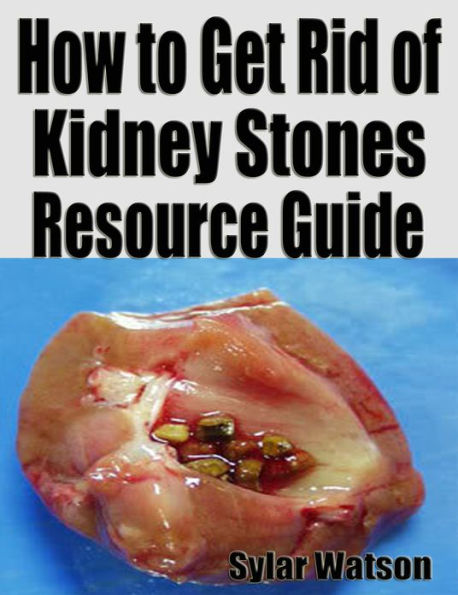 How to Get Rid of Kidney Stones Resource Guide