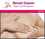 Breast Cancer: Signs and Symptoms