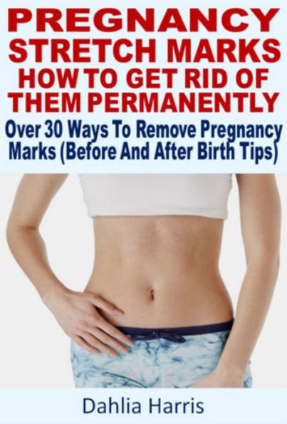 Pregnancy Stretch Marks : How To Get Rid Of Them Permanently Over 30 Ways To Remove Pregnancy Marks (Before And After Birth Tips)