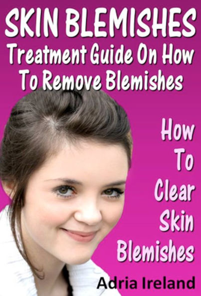 Skin Blemishes : Treatment Guide On How To Remove Blemishes And Clear Your Face