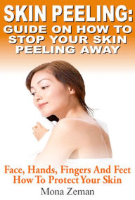 Title: Skin Peeling : Guide On How To Stop Your Skin Peeling Away, Author: Mona Zeman