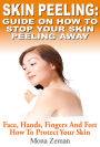 Skin Peeling : Guide On How To Stop Your Skin Peeling Away