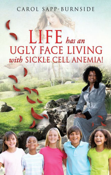 LIFE HAS AN UGLY FACE LIVING WITH SICKLE CELL ANEMIA!