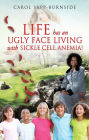 LIFE HAS AN UGLY FACE LIVING WITH SICKLE CELL ANEMIA!