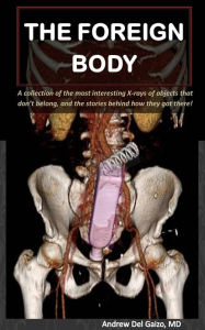 Title: The Foreign Body: A collection of the most interesting X-rays of things that dont belong and the stories behind how they got there!, Author: Andrew Del Gaizo