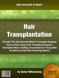 Title: Hair Transplantation Reveals The Real Secrets Behind Transplant Surgery, How to Find a Good Hair Transplant Surgeon, Transplant Micro Grafting, Procedures for Young Men As Well As Costs and Financing Options, Author: Dexter Williamsburg