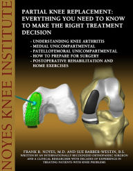 Title: Partial Knee Replacement: Everything You Need to Know to Make the Right Treatment Decision: Understanding knee arthritis - Medial unicompartmental - Patellofemoral unicompartmental - How to prepare fo, Author: Frank Noyes