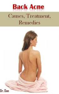 Title: Back Acne: Causes, Treatment, Remedies, Author: Dr. Dan