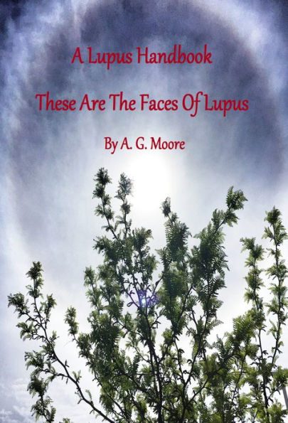A Lupus Handbook: These Are the Faces of Lupus