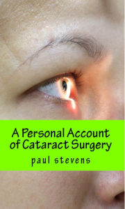 Title: A Personal Account of Cataract Surgery, Author: Paul Stevens