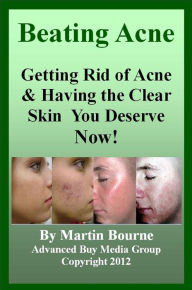 Title: Beating Acne: Getting Rid of Acne & Having the Skin You Deserve Now!, Author: Advanced Buy Media Group