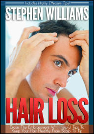 Title: Hair Loss: Erase The Embrassment With Helpful Tips To Keep Your Hair Healthy From Scalp To Tip, Author: Stephen Williams