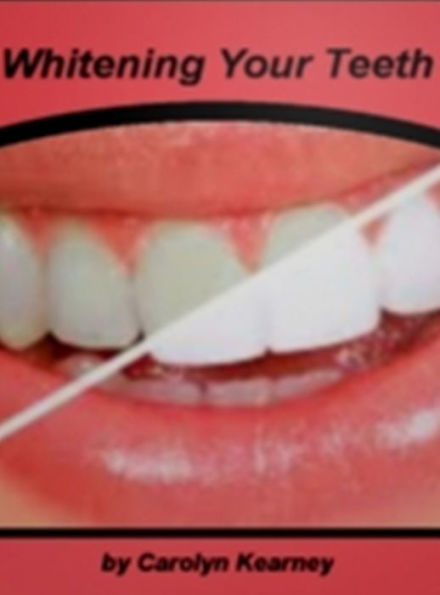 Whitening Your Teeth: A Complete Guide For Tray-Based Teeth Whitening, Laser Teeth Whitening, Rembrandt Teeth Whitening System, ZOOM! Chair Side Teeth Whitening System and Preparing for a Laser Teeth Whitening Procedure!