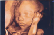 Title: 3D 4D Baby Imaging Ultrasound Service Start Up Sample Business Plan!, Author: Scott Proctor