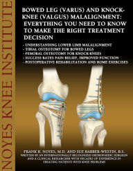 Title: Bowed Leg (Varus) and Knock-Knee (Valgus) Malalignment: Everything You Need to Know to Make the Right Treatment Decision - Understanding lower limb malalignment - Tibial osteotomy for bowed legs - Femoral osteotomy for knock-knees - Success rates pain rel, Author: Frank R. Noyes