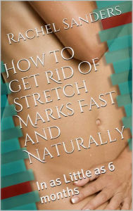 Title: How to get rid of Stretch Marks Fast and Naturally removal in as little as 6 months, Author: Rachel Sanders