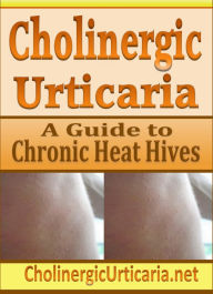 Title: Cholinergic Urticaria: A Guide to Chronic Heat Hives, Author: B. Page