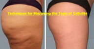 Title: Techniques for Mastering the Topic of Cellulite, Author: Christopher McNeil