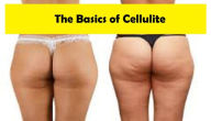 Title: The Basics of Cellulite, Author: Christopher McNeil