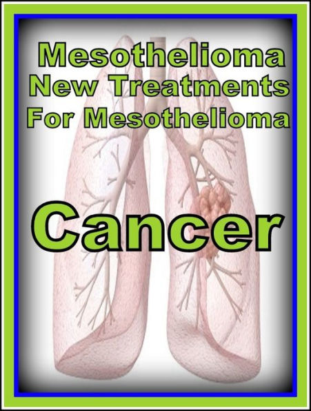 Best of the Sellers Mesothelioma New Treatments For Mesothelioma C ( exercise, meditation, acupuncture, disease, digestive system, formula, medicine, remedy, fix, treatment, action, conduct, behavior, handling, gastrin, fitness, vitamins, healing, diet )